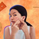Adult Acne-How Do You Get Rid of It? Adult Acne-How Do You Get Rid of It Sisterhood Agenda